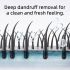 [buy 1 get 1 free] Selenium Disulfide Anti-Dandruff Shampoo 300ml – Oil Control, Itch Relief, Scalp Health with Natural Ingredients