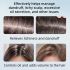 Selenium Disulfide Dandruff Shampoo 300ml – Extra Strength Scalp Treatment for Itchy, Oily Scalp, Flake Control & Seborrheic Dermatitis Relief