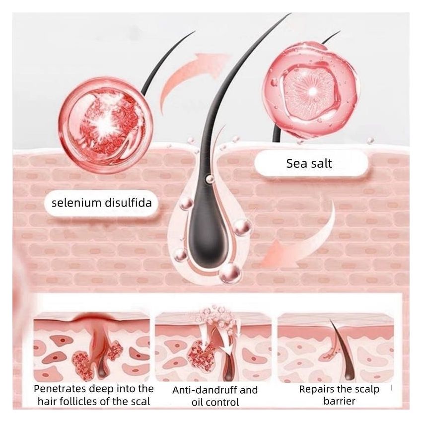 [buy 1 get 1 free] Selenium Disulfide Anti-Dandruff Shampoo 300ml – Oil Control, Itch Relief, Scalp Health with Natural Ingredients