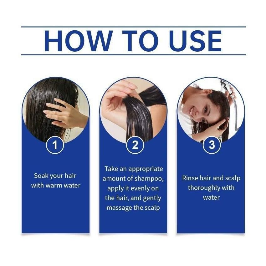 [buy 1 get 1 free] Selenium Disulfide Anti-Dandruff Shampoo 300ml – Oil Control, Itch Relief, Scalp Health with Natural Ingredients