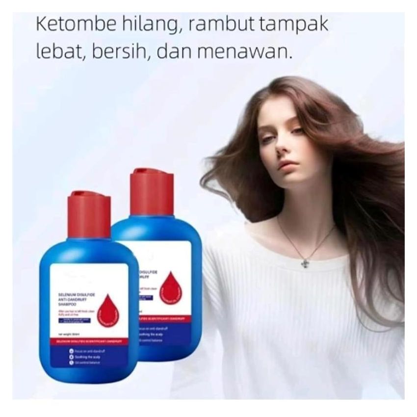 Selenium Disulfide Dandruff Shampoo 300ml – Extra Strength Scalp Treatment for Itchy, Oily Scalp, Flake Control & Seborrheic Dermatitis Relief