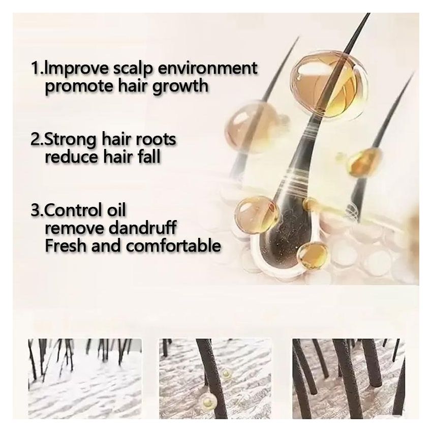 Selenium Disulfide Dandruff Shampoo 300ml – Extra Strength Scalp Treatment for Itchy, Oily Scalp, Flake Control & Seborrheic Dermatitis Relief